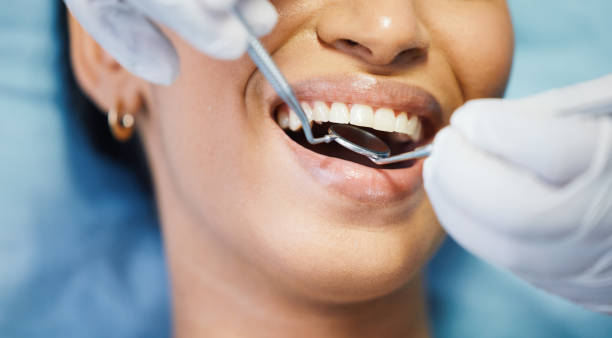 Best Emergency Treatment for Dental Infections or Abscesses in Winters, CA